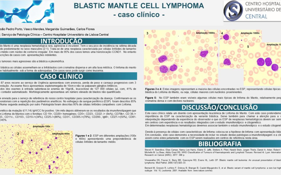 P69 – Blastic Mantle Cell Lymphoma – Caso Clínico –