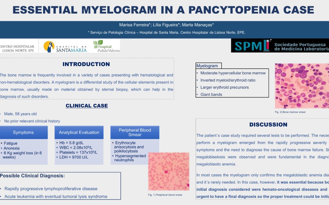 P81 – Essential Myelogram In A Pancytopenia Case